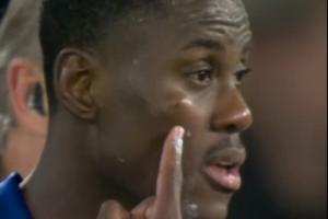 动作不断！因卡皮耶肘击查洛巴面部染黄，后者脸部都肿了